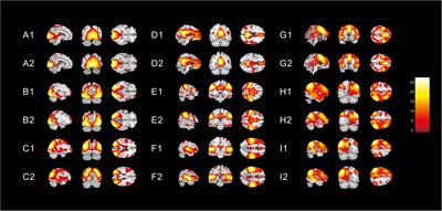 Altered Functional Connectivity in Children With Low-Function Autism Spectrum Disorders